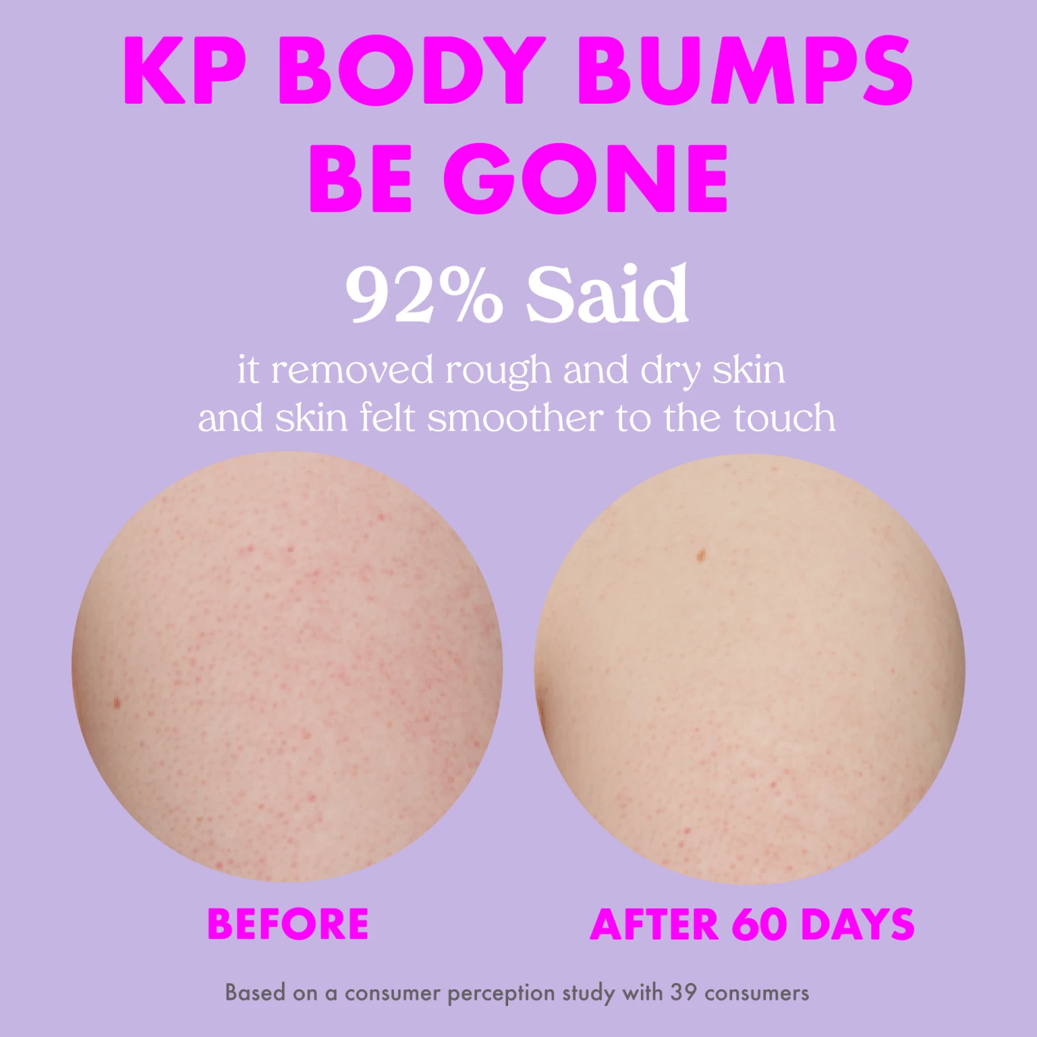 KP Body Bumps Be Gone Clarifying Body Scrub - Image 12