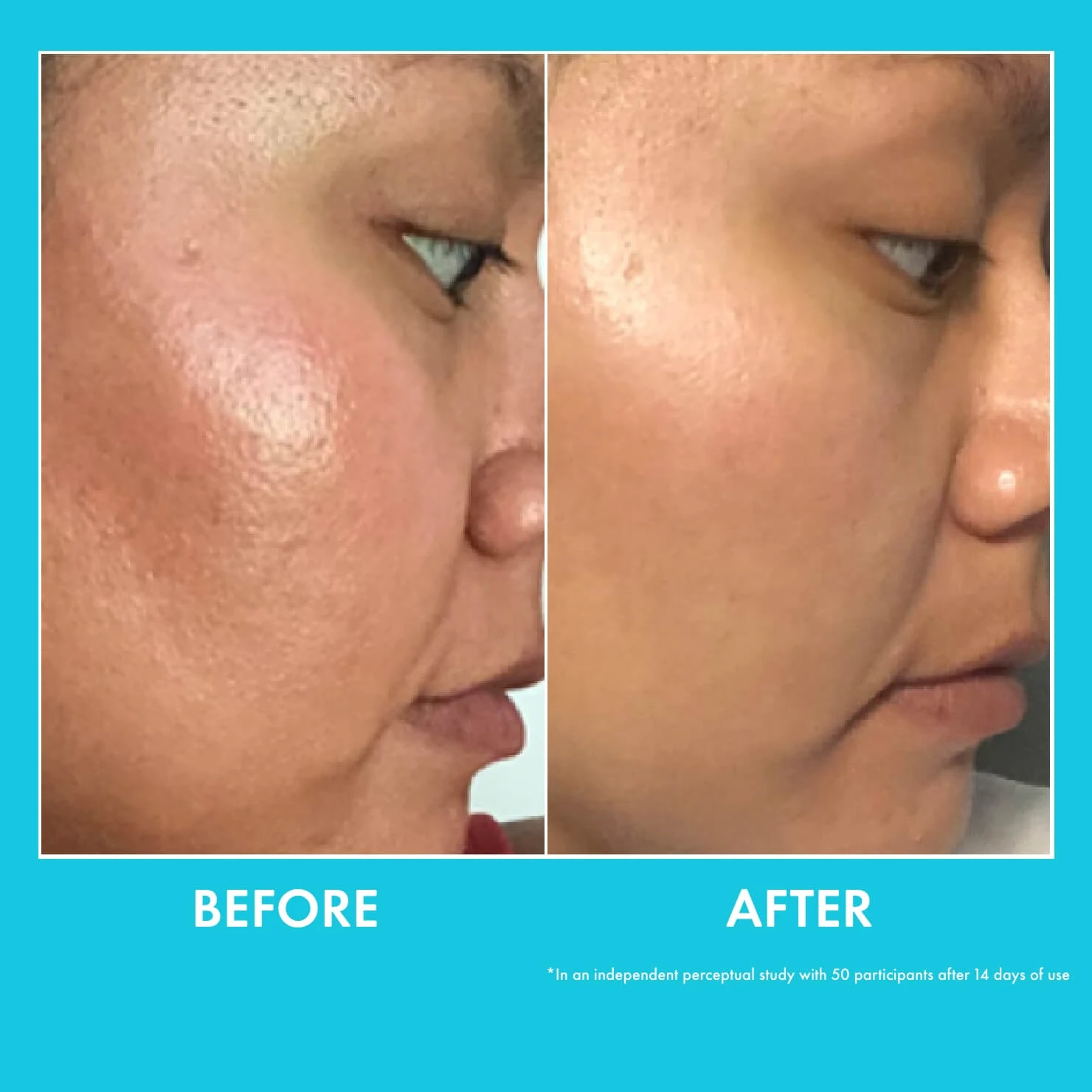 Moisture Whipped Ceramide Cream - Image 3