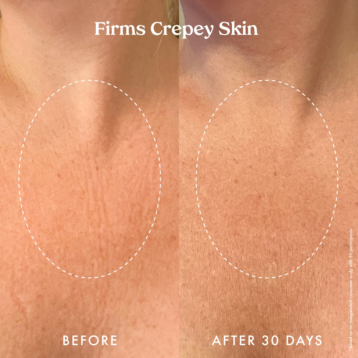 Ultra Renewal Retinol Body Cream - Image 6