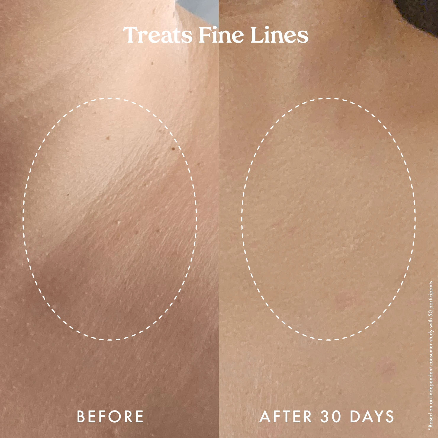 Ultra Renewal Retinol Body Cream - Image 7