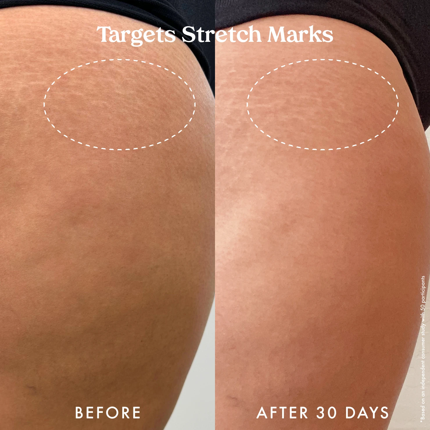 Ultra Renewal Retinol Body Cream - Image 10