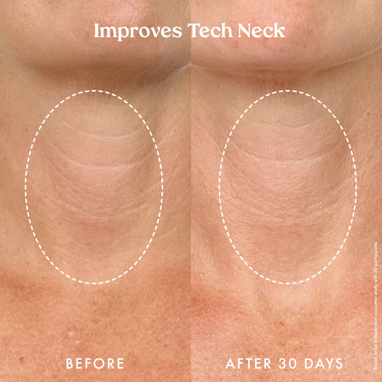 Ultra Renewal Retinol Body Cream - Image 8