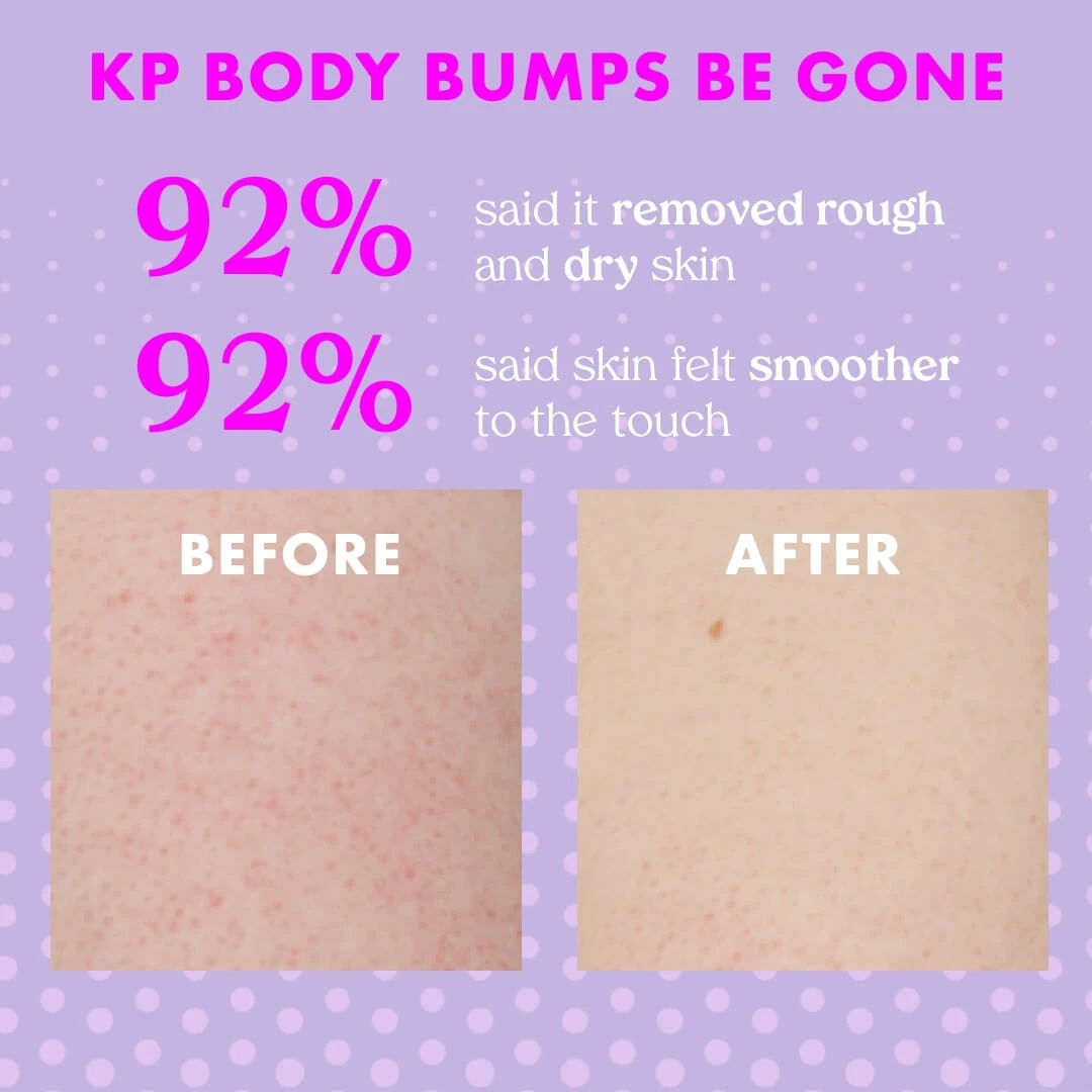 KP Body Bumps Be Gone Clarifying Body Scrub - Image 10