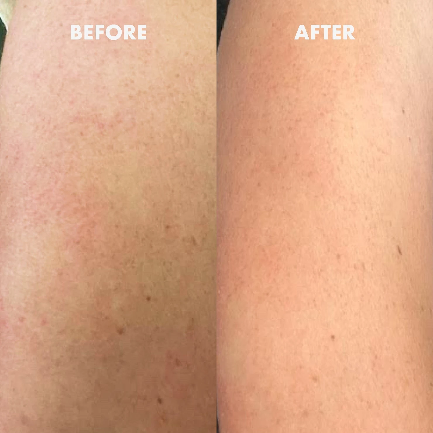 Silk Skin Body Ritual - Image 9